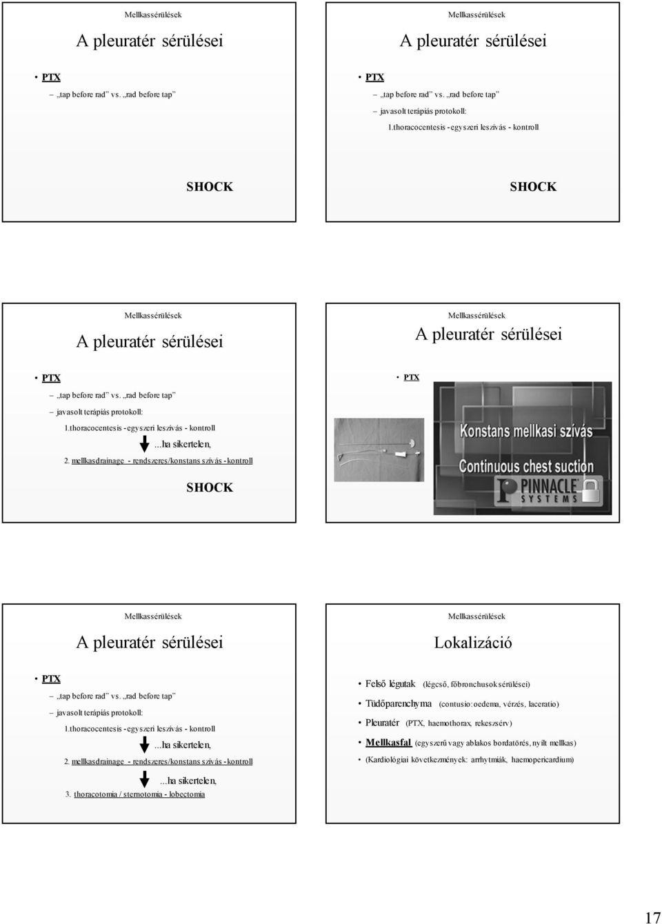 thoracocentesis -egyszeri leszívás - kontroll...ha sikertelen, 2. mellkasdrainage - rendszeres/konstans szívás -kontroll A pleuratér sérülései Lokalizáció PTX tap before rad vs.