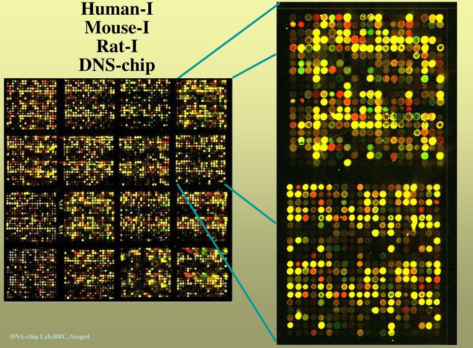 Human-I