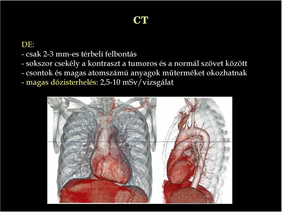 között - csontok és magas atomszámú anyagok