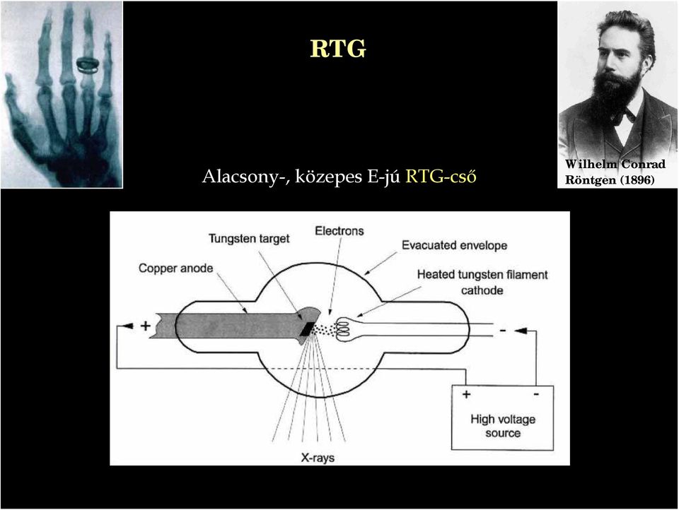 RTG-cső Wilhelm