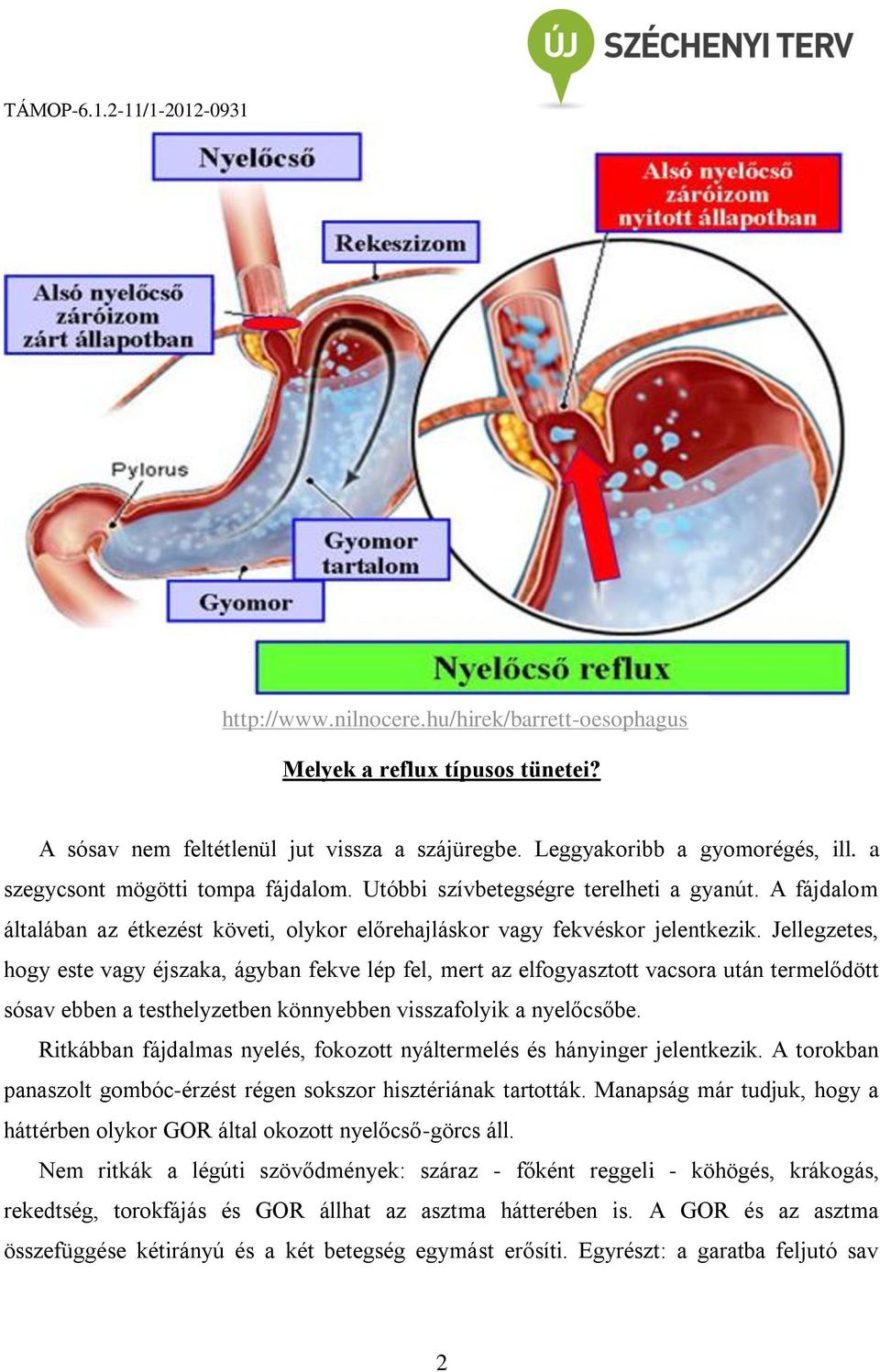 Jellegzetes, hogy este vagy éjszaka, ágyban fekve lép fel, mert az elfogyasztott vacsora után termelődött sósav ebben a testhelyzetben könnyebben visszafolyik a nyelőcsőbe.