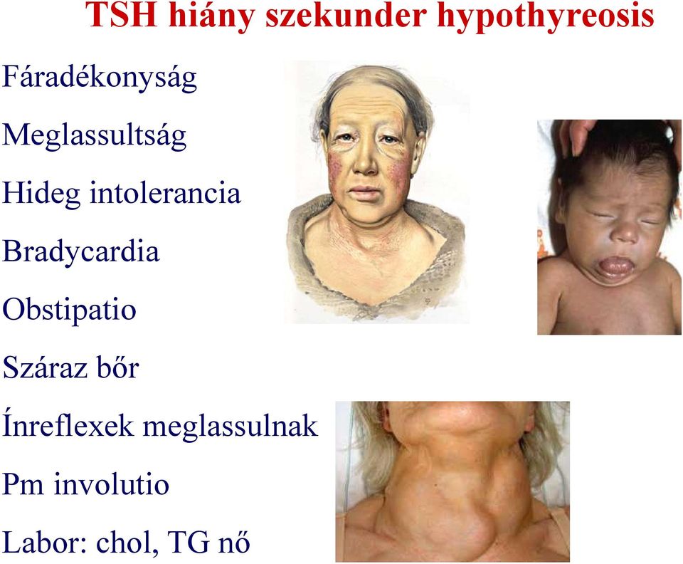 intolerancia Bradycardia Obstipatio Száraz