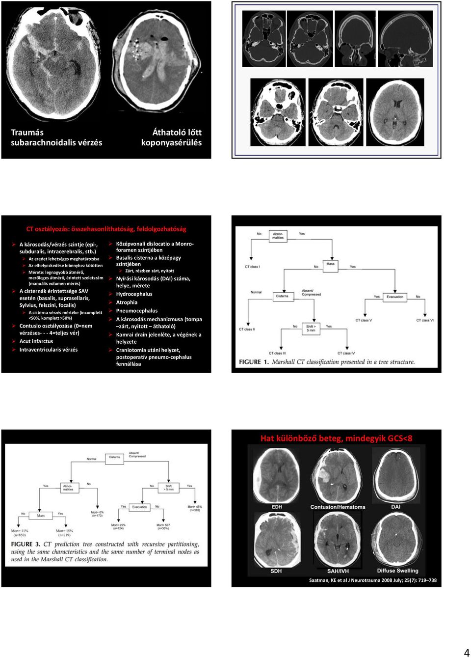 (basalis, suprasellaris, Sylvius, felszíni, focalis) A cisterna vérzés mértéke (incomplett <50%, komplett >50%) Contusio osztályozása (0=nem vérzéses 4=teljes vér) Acut infarctus Intraventricularis