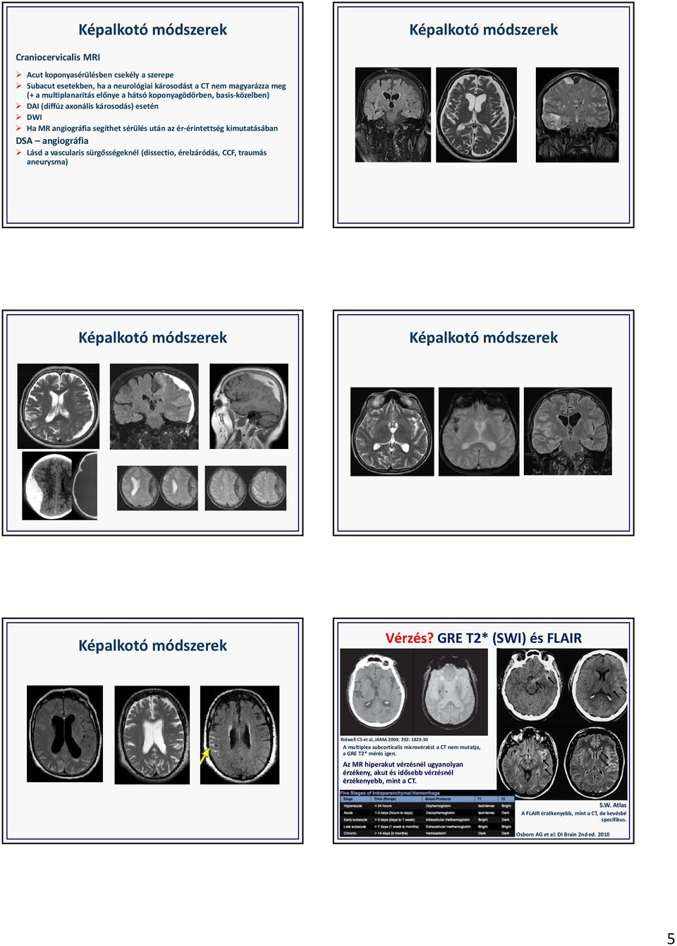 sürgősségeknél (dissectio, érelzáródás, CCF, traumás aneurysma) Képalkotó módszerek Képalkotó módszerek Képalkotó módszerek Vérzés?