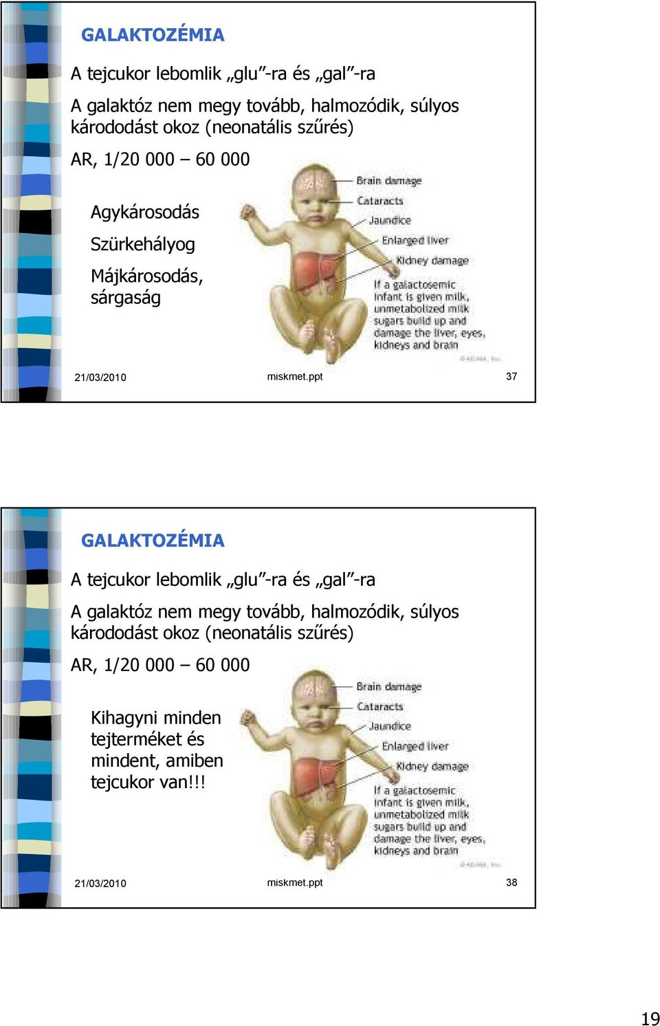 ppt 37  (neonatális szűrés) AR, 1/20 000 60 000 Kihagyni minden tejterméket és mindent, amiben tejcukor van!