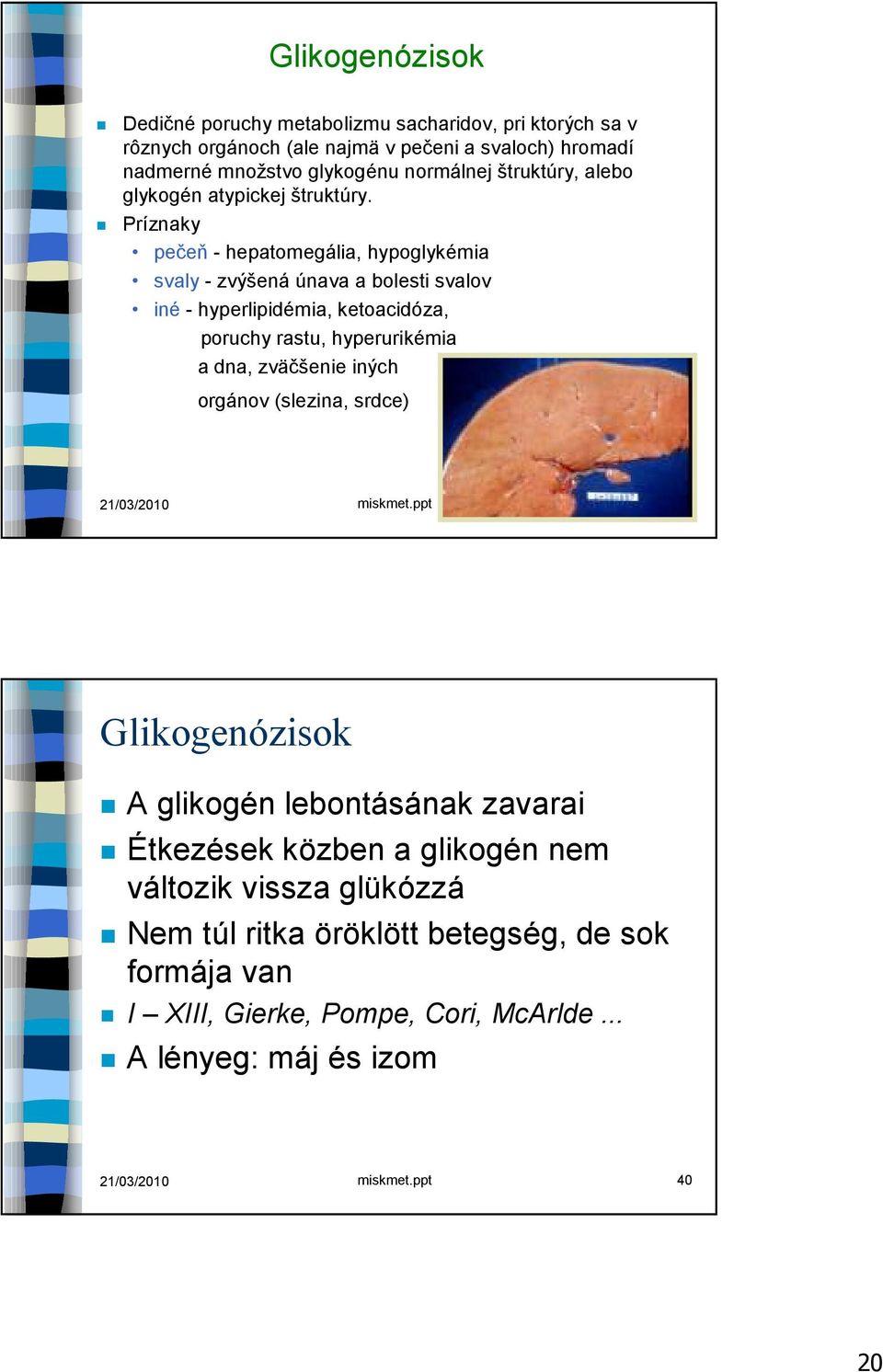 Príznaky pečeň - hepatomegália, hypoglykémia svaly - zvýšená únava a bolesti svalov iné - hyperlipidémia, ketoacidóza, poruchy rastu, hyperurikémia a dna, zväčšenie iných