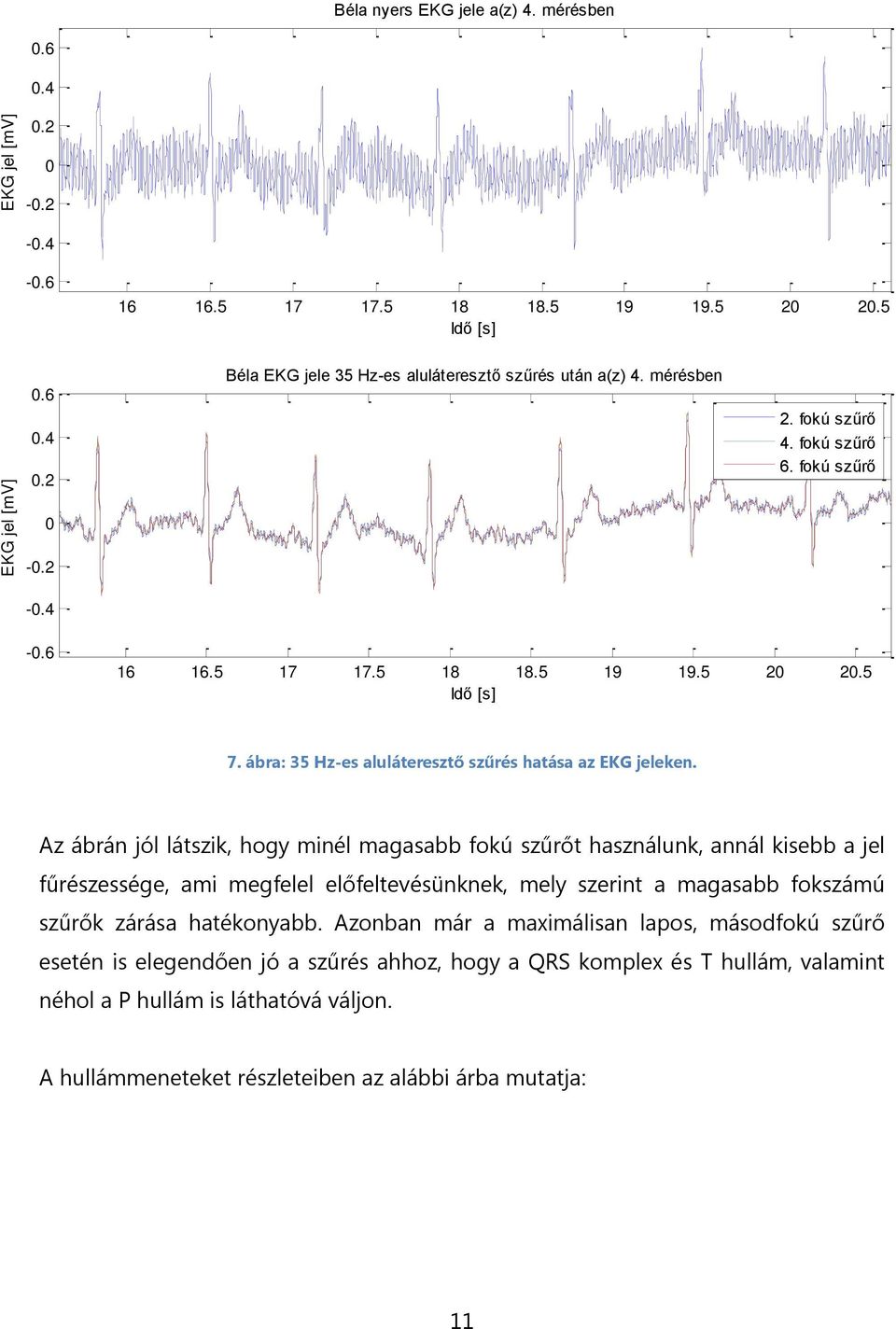 Az ábrán jól látszik, hogy minél magasabb fokú szűrőt használunk, annál kisebb a jel fűrészessége, ami megfelel előfeltevésünknek, mely szerint a magasabb fokszámú szűrők zárása