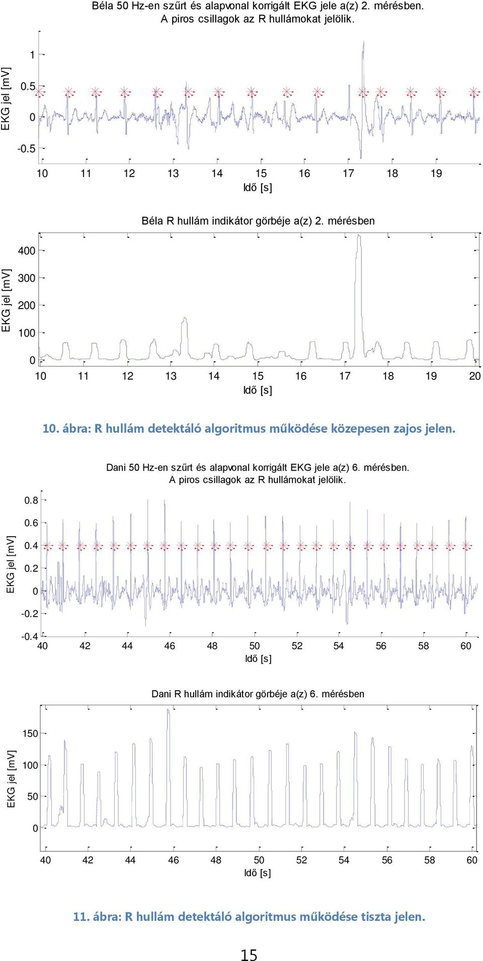 ábra: R hullám detektáló algoritmus működése közepesen zajos jelen..8.6.4 Dani 5 Hz-en szűrt és alapvonal korrigált EKG jele a(z) 6. mérésben.