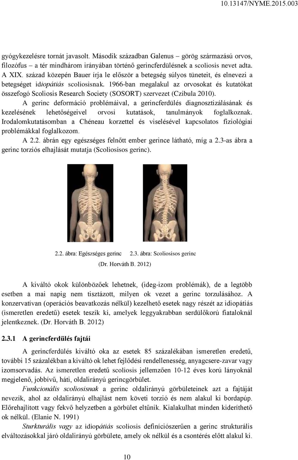 1966-ban megalakul az orvosokat és kutatókat összefogó Scoliosis Research Society (SOSORT) szervezet (Czibula 2010).