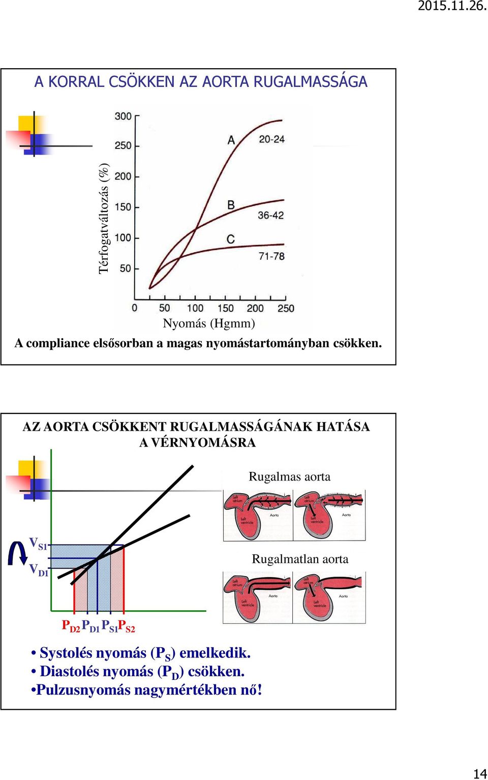 AZ AORTA CSÖKKENT RUGALMASSÁGÁNAK HATÁSA A VÉRNYOMÁSRA Rugalmas aorta V S1 V D1