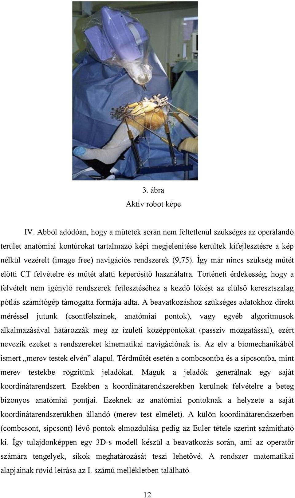 navigációs rendszerek (9,75). Így már nincs szükség műtét előtti CT felvételre és műtét alatti képerősítő használatra.