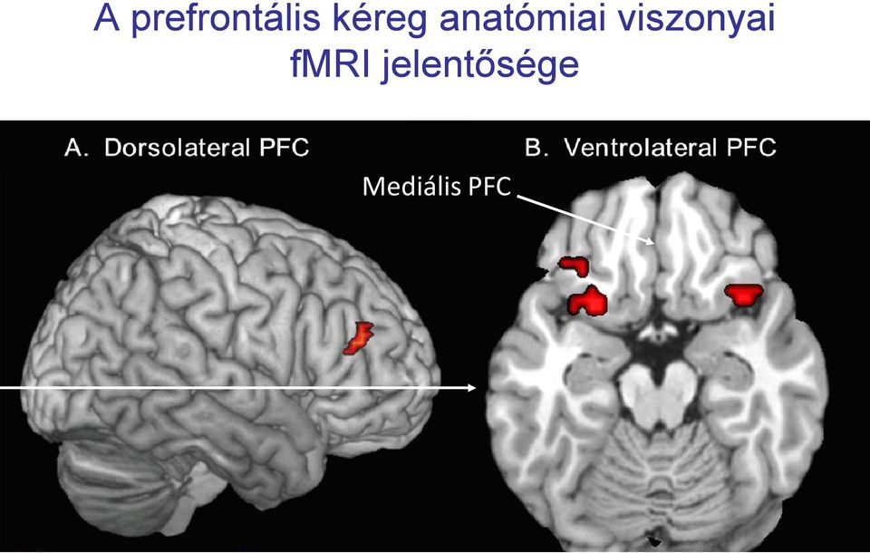 viszonyai fmri