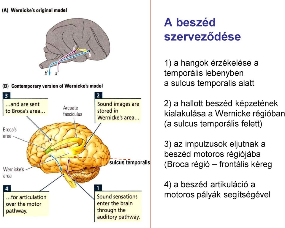 sulcus temporális felett) sulcus temporalis 3) az impulzusok eljutnak a beszéd