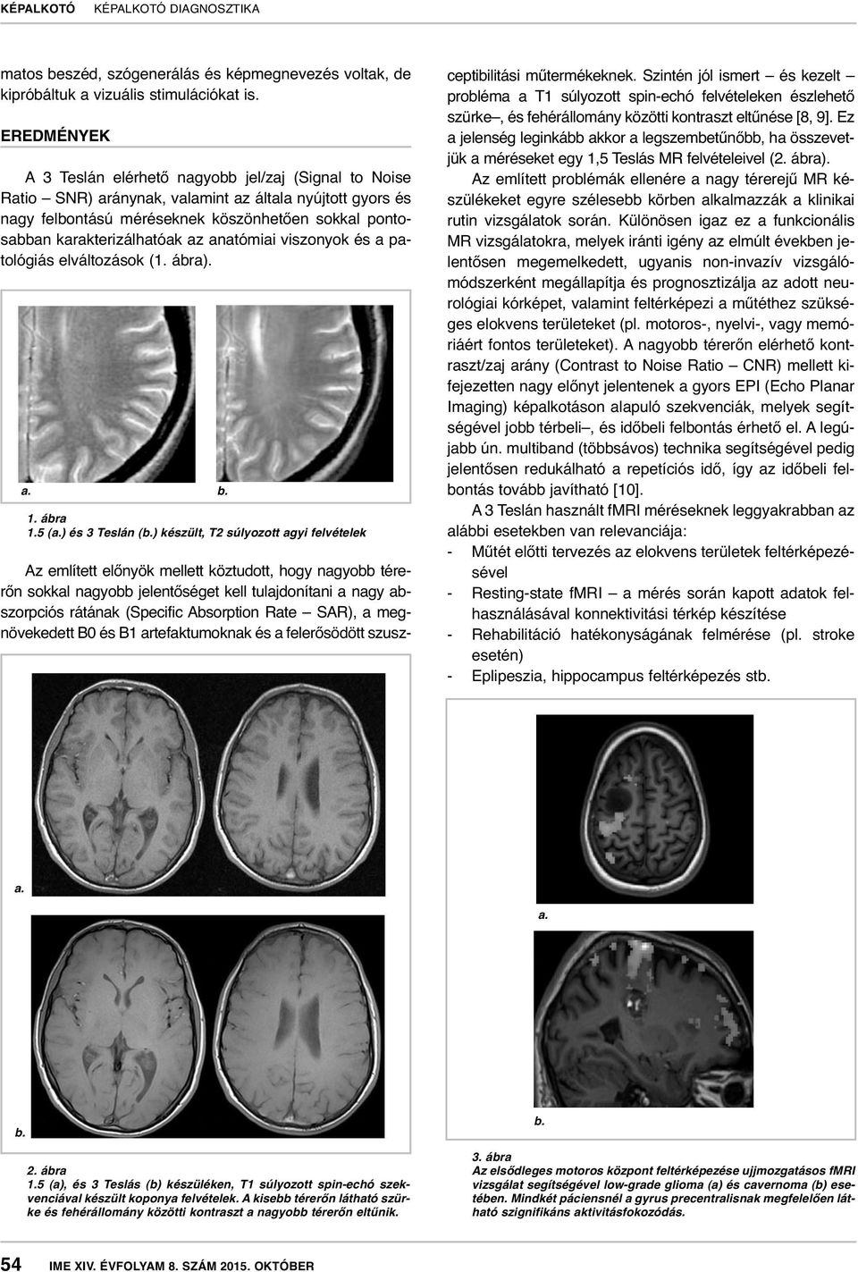 az anatómiai viszonyok és a patológiás elváltozások (1. ábra). 1. ábra 1.5 (a.) és 3 Teslán (b.