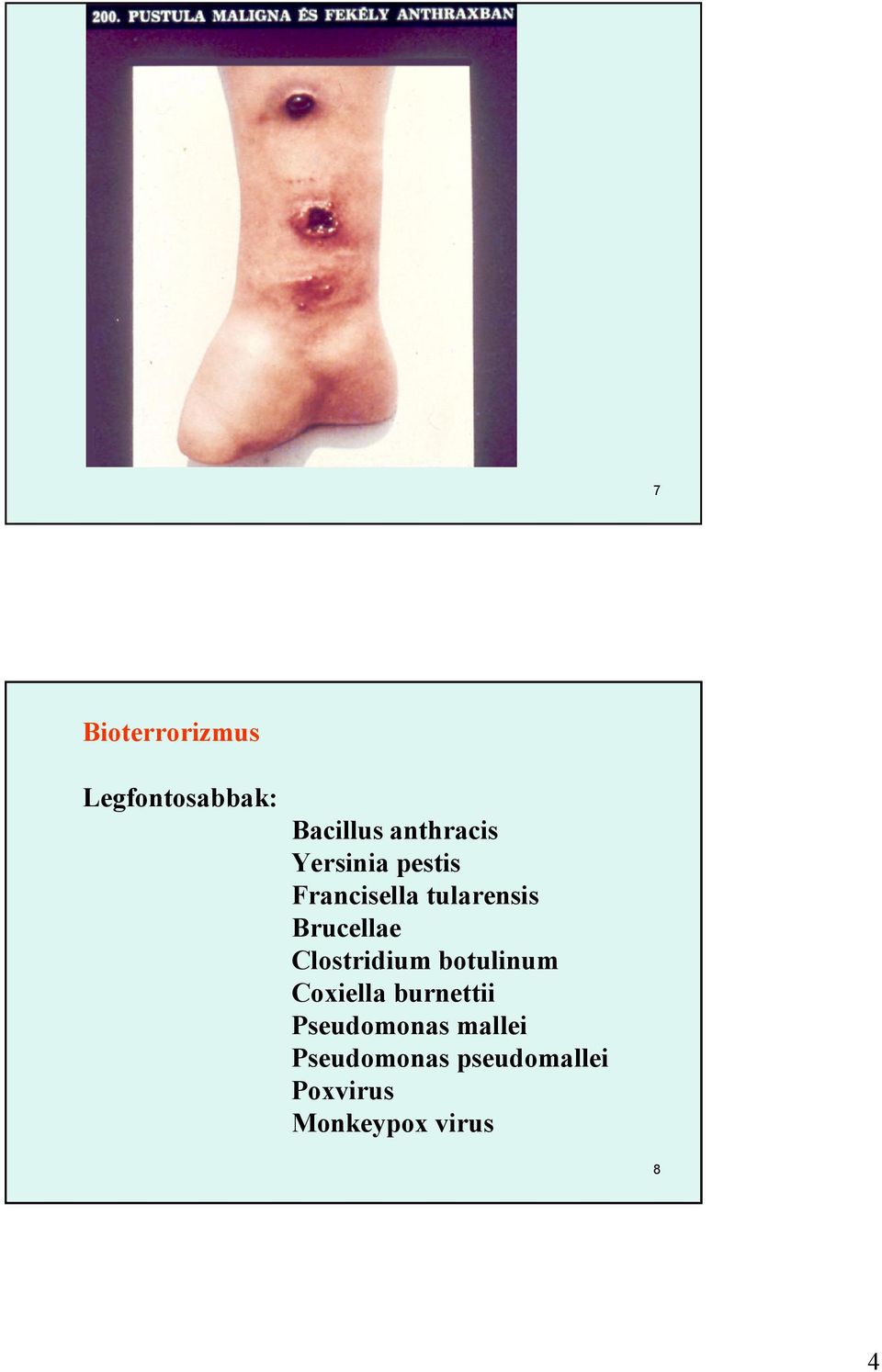 Clostridium botulinum Coxiella burnettii Pseudomonas