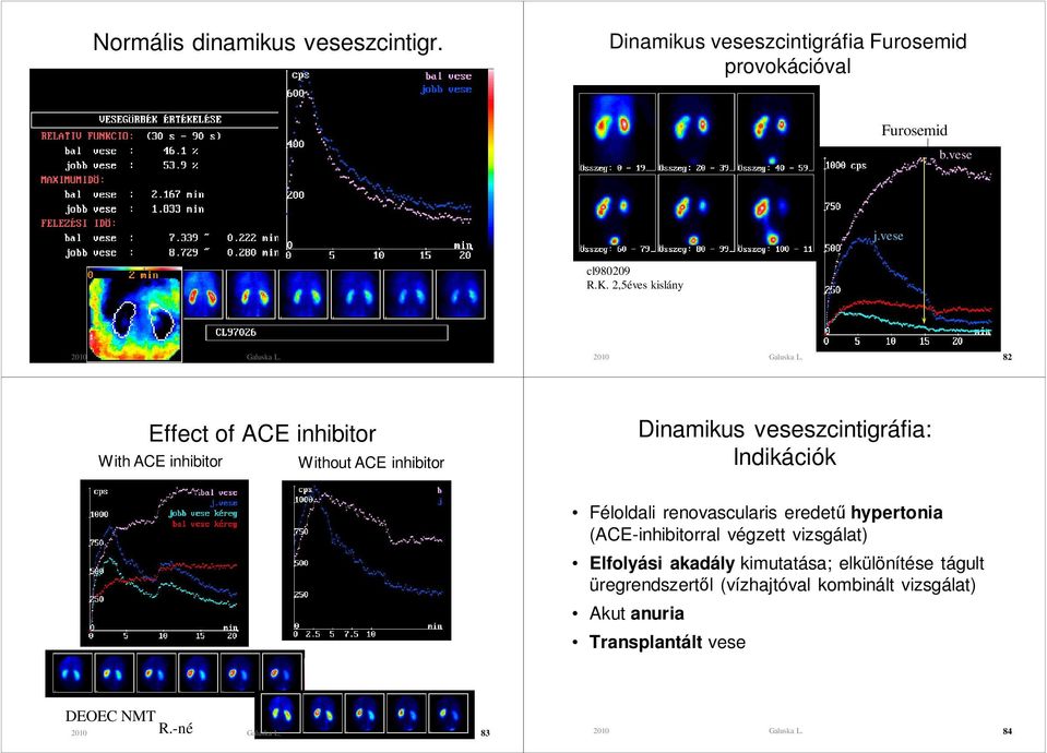 Indikációk Féloldali renovascularis eredető hypertonia (ACE-inhibitorral végzett vizsgálat) Elfolyási akadály