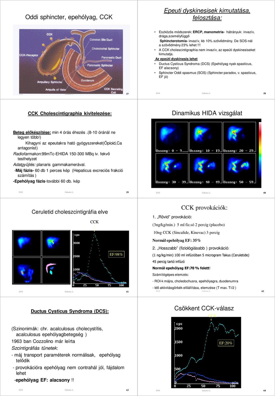 Az epeúti dyskinesis lehet Ductus Cysticus Syndroma (DCS) (Epehólyag nyak spasticus, EF alacsony) Sphincter Oddi spasmus (SOS) (Sphincter paradox, v.