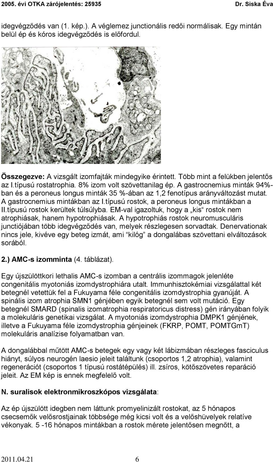 A gastrocnemius mintákban az I.típusú rostok, a peroneus longus mintákban a II.típusú rostok kerültek túlsúlyba. EM-val igazoltuk, hogy a kis rostok nem atrophiásak, hanem hypotrophiásak.