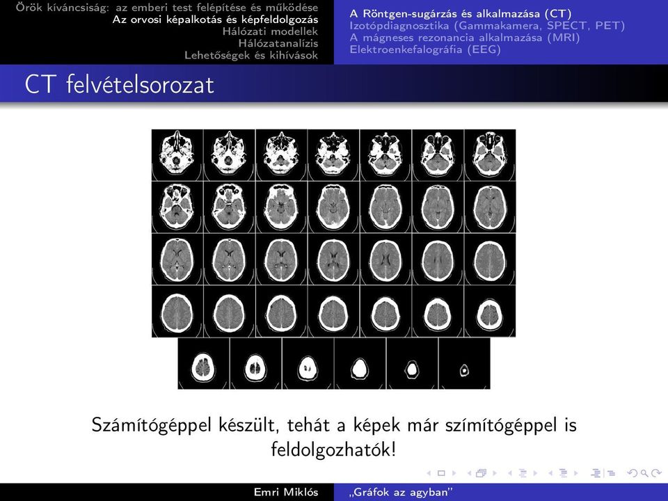 rezonancia alkalmazása (MRI) Elektroenkefalográfia (EEG)