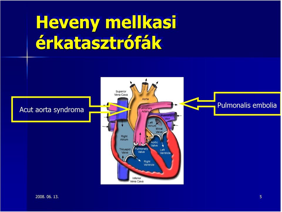 aorta syndroma