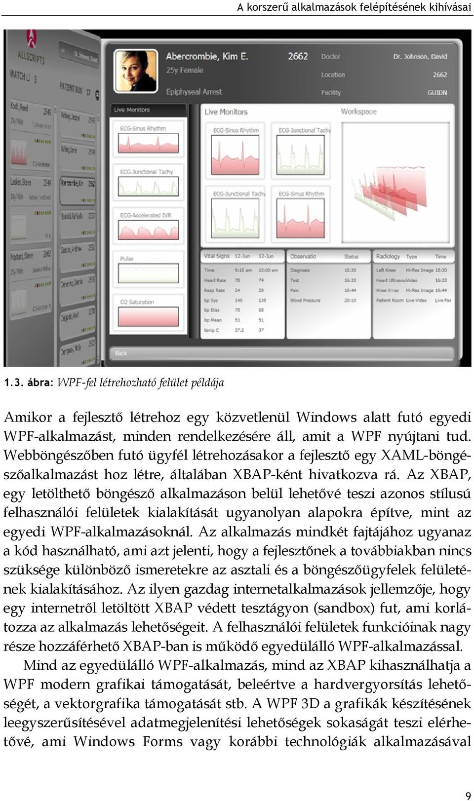 Webböngészőben futó ügyfél létrehozásakor a fejlesztő egy XAML-böngészőalkalmazást hoz létre, általában XBAP-ként hivatkozva rá.