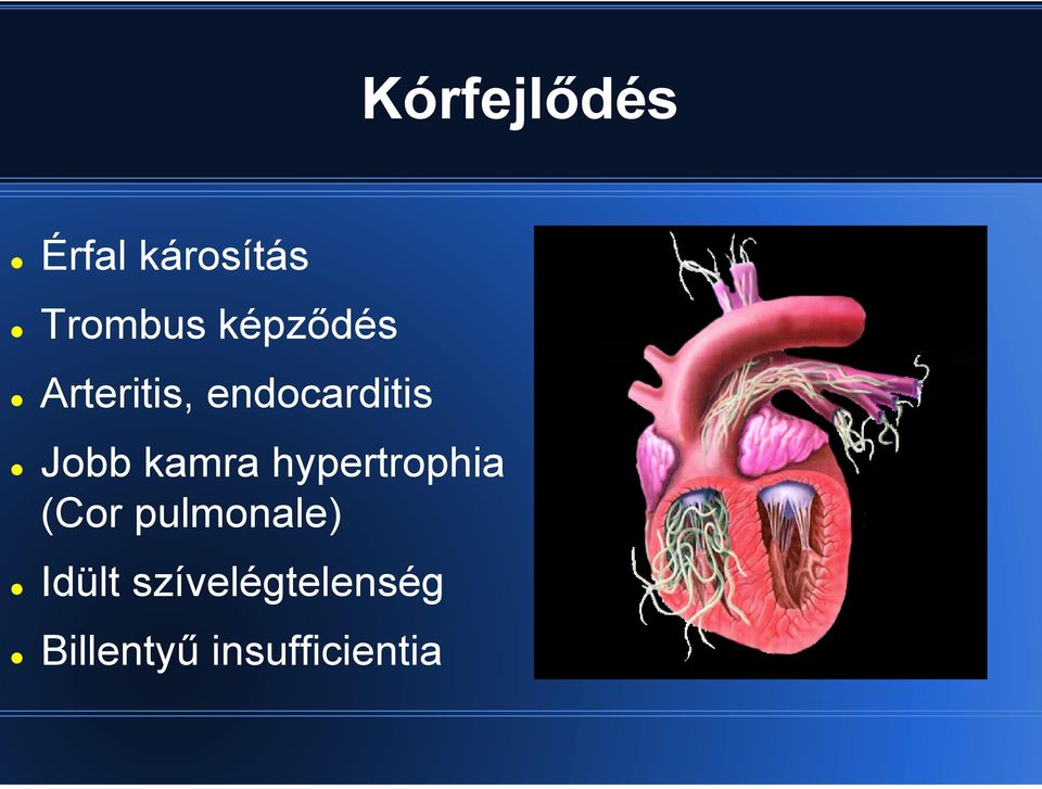 kamra hypertrophia (Cor pulmonale)