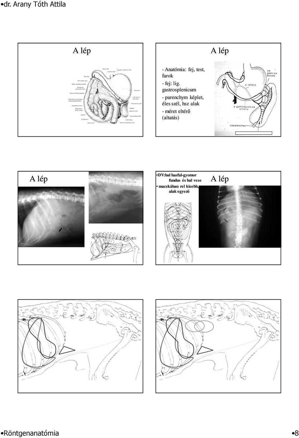méret eltérı (altatás) A lép DV:bal hasfal-gyomor fundus és
