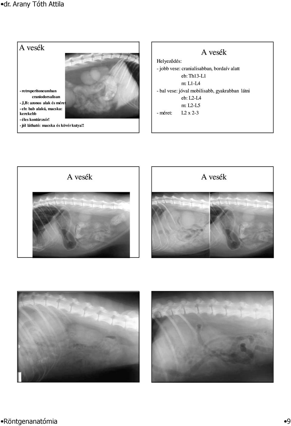 ! A vesék Helyezıdés: - jobb vese: cranialisabban, bordaív alatt eb: Th13-L1 m: L1-L4 - bal