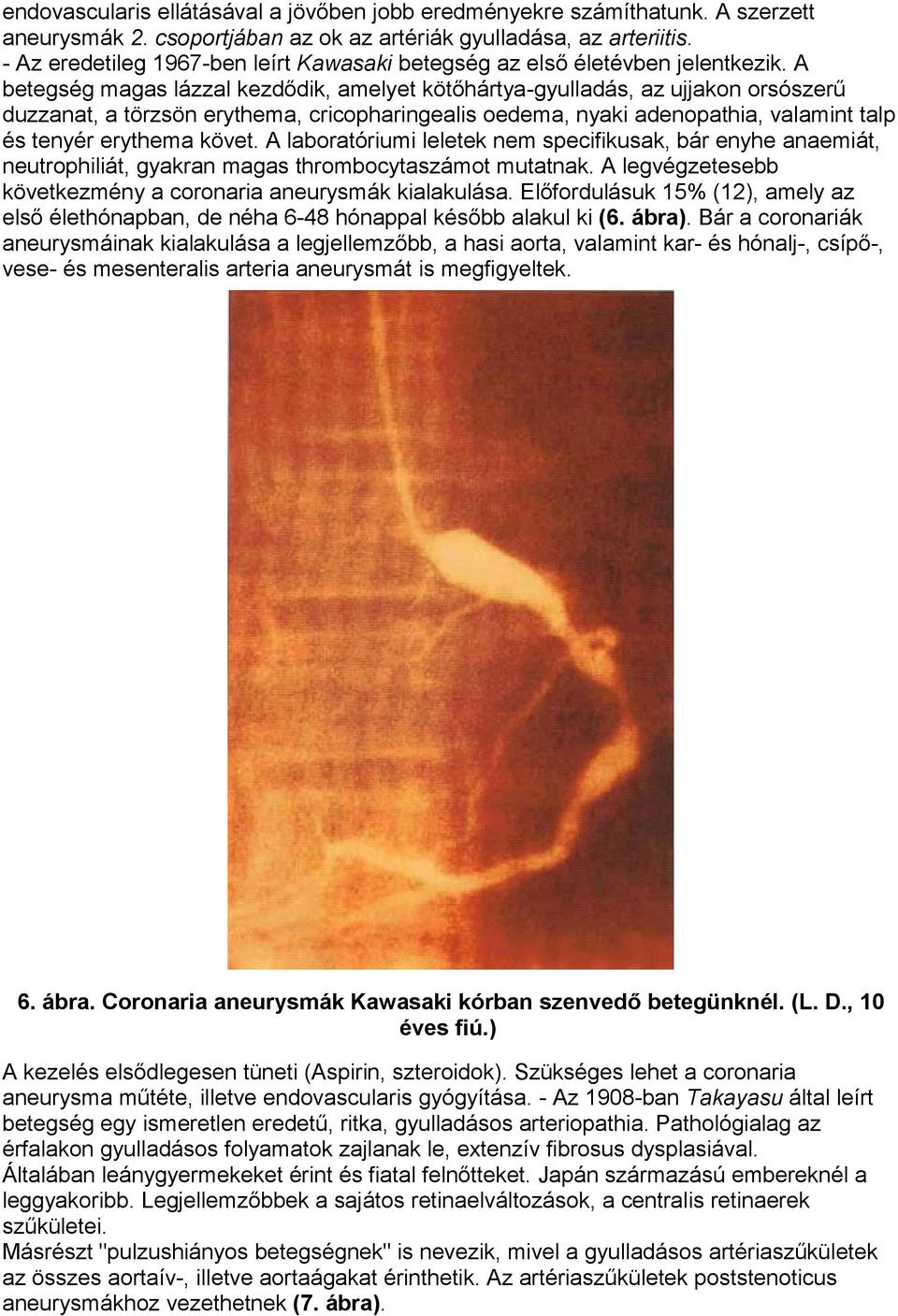 A betegség magas lázzal kezdődik, amelyet kötőhártya-gyulladás, az ujjakon orsószerű duzzanat, a törzsön erythema, cricopharingealis oedema, nyaki adenopathia, valamint talp és tenyér erythema követ.