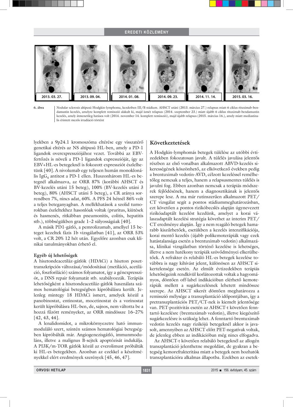 ) miatt újabb 6 ciklus rituximab-bendamustin kezelés, amely átmenetileg hatásos volt (2014. november 14. komplett remisszió), majd újabb relapsus (2015. március 16.