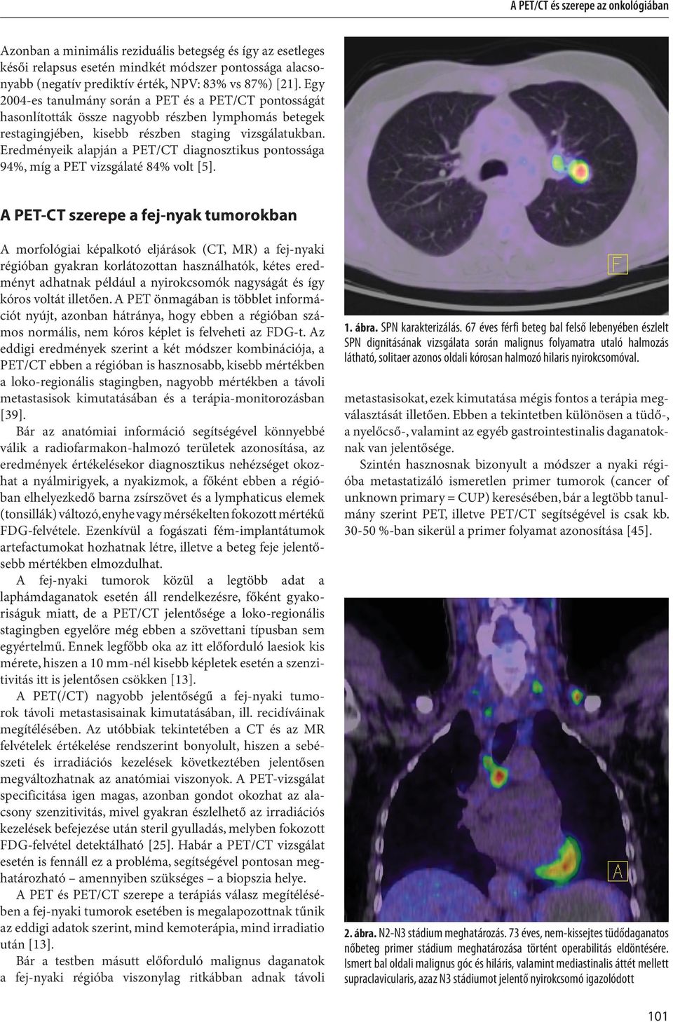 Eredményeik alapján a PET/CT diagnosztikus pontossága 94%, míg a PET vizsgálaté 84% volt [5].