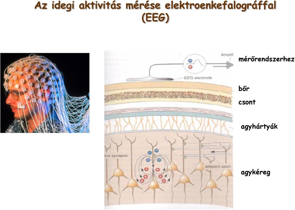 elektroenkefalográffal