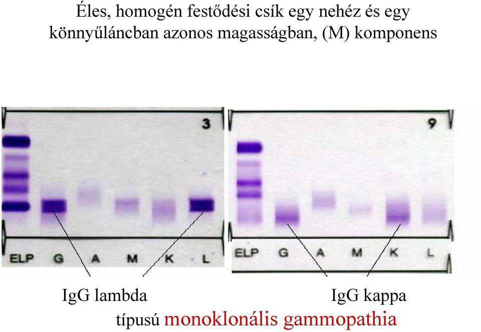 magasságban, (M) komponens IgG