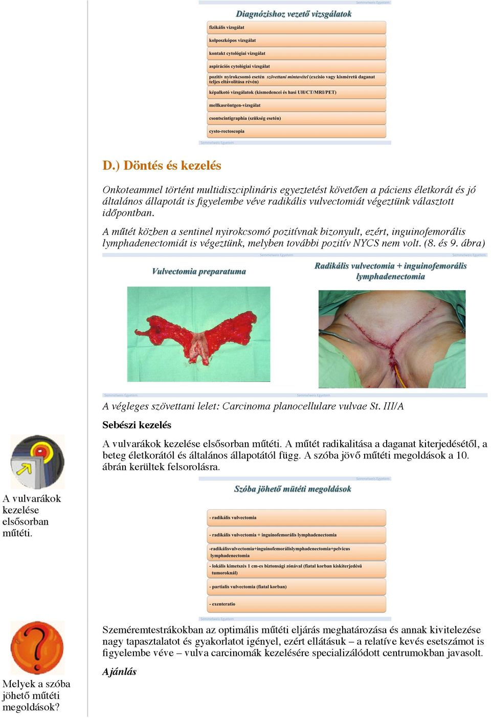 ábra) A végleges szövettani lelet: Carcinoma planocellulare vulvae St. III/A Sebészi kezelés A vulvarákok kezelése elsősorban műtéti.