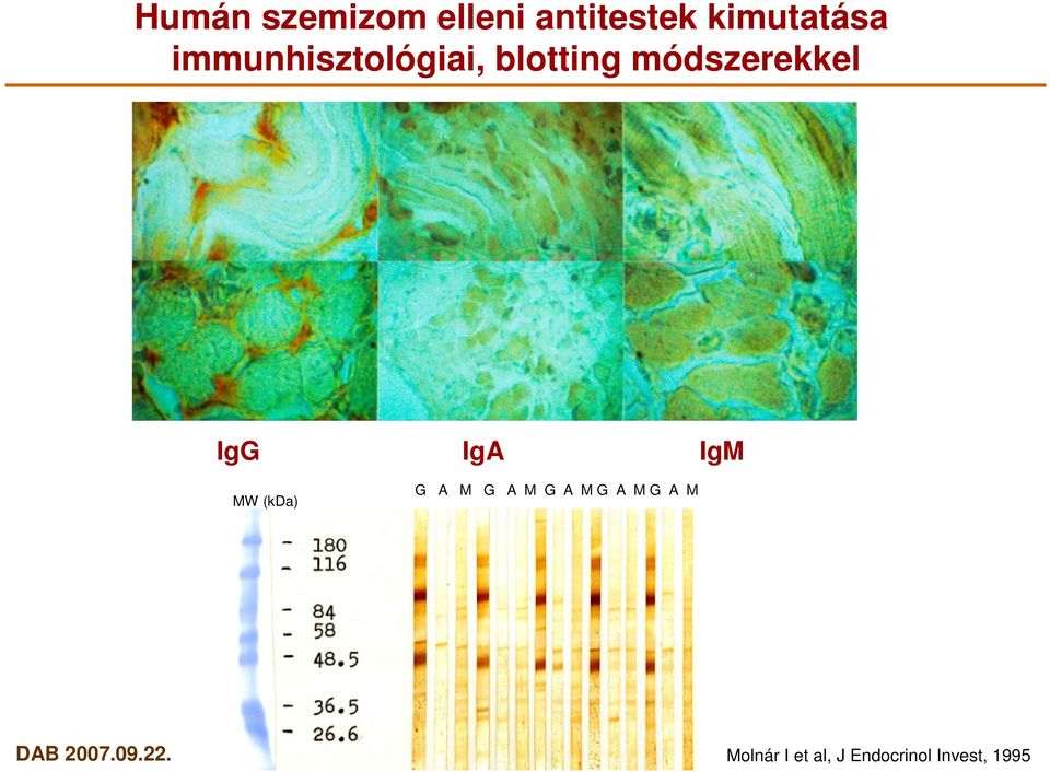 IgG MW (kda) IgA IgM G A M G A M G A MG A
