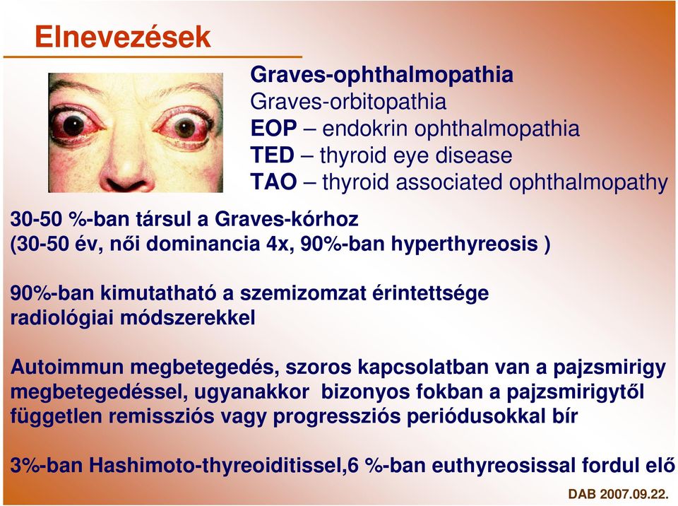 érintettsége radiológiai módszerekkel Autoimmun megbetegedés, szoros kapcsolatban van a pajzsmirigy megbetegedéssel, ugyanakkor bizonyos