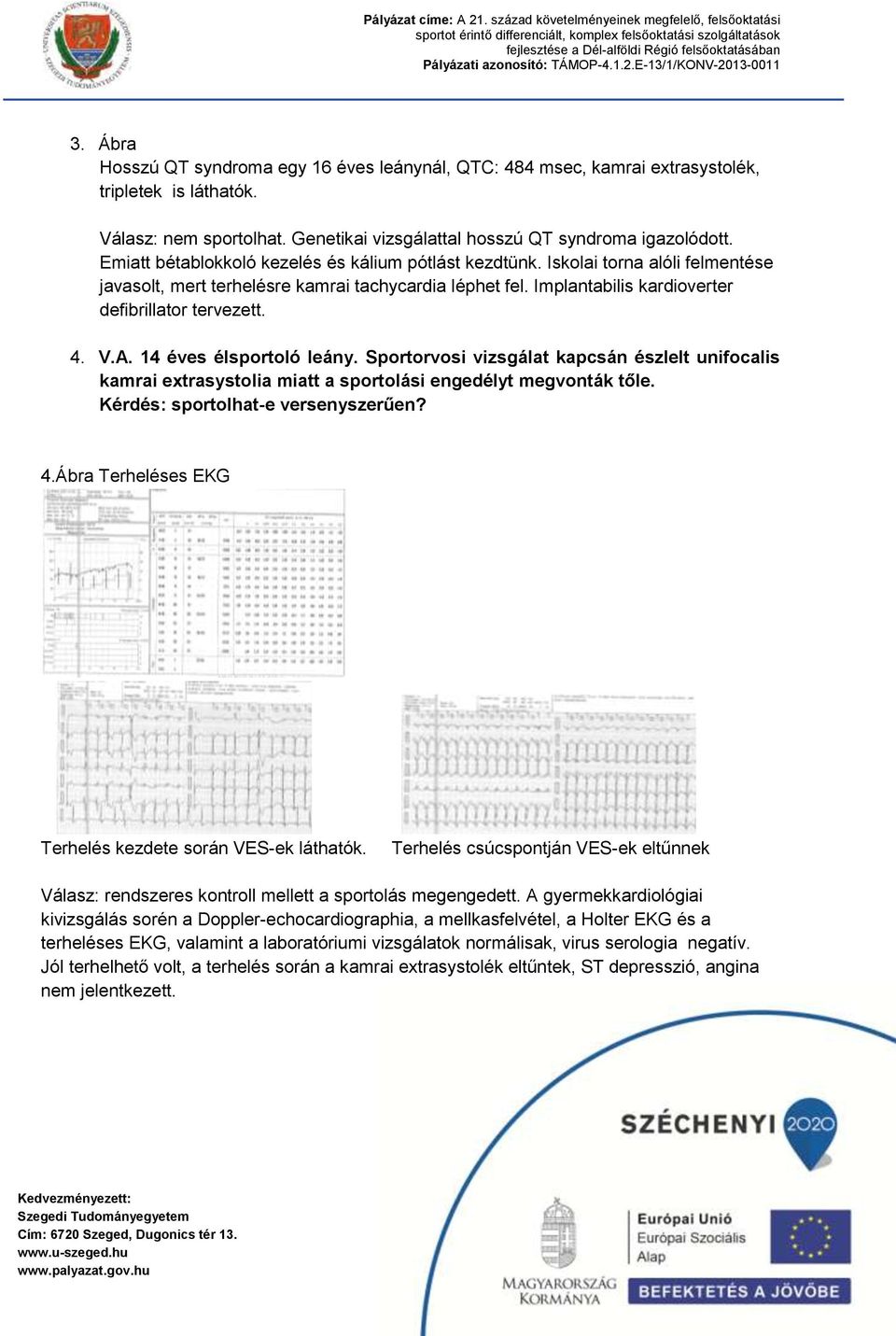 V.A. 14 éves élsportoló leány. Sportorvosi vizsgálat kapcsán észlelt unifocalis kamrai extrasystolia miatt a sportolási engedélyt megvonták tőle. Kérdés: sportolhat-e versenyszerűen? 4.