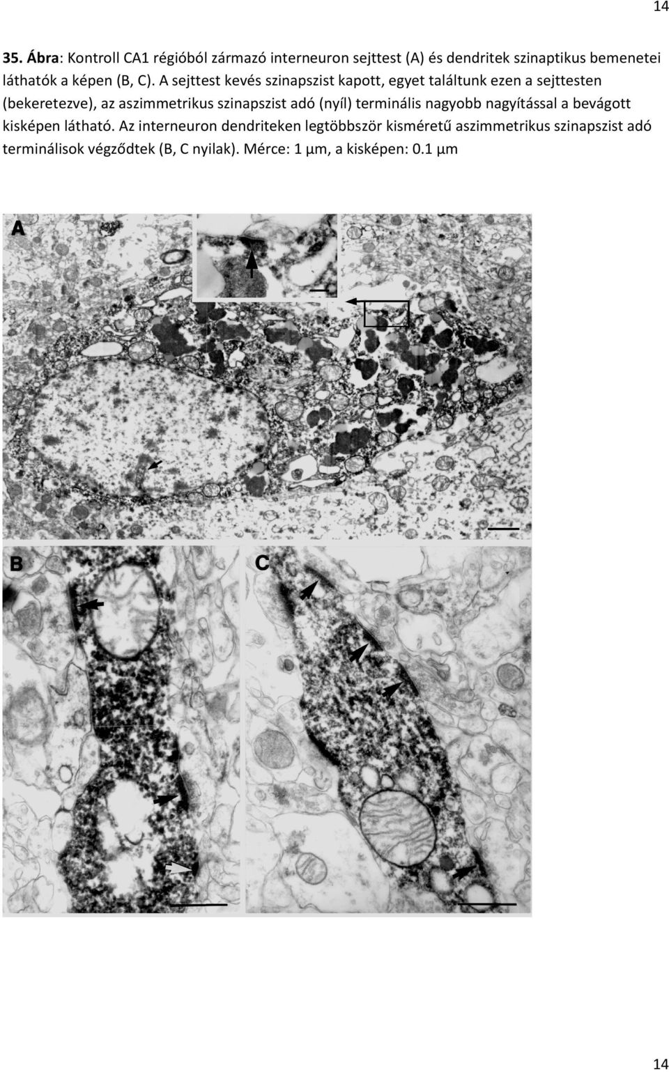 C). A sejttest kevés szinapszist kapott, egyet találtunk ezen a sejttesten (bekeretezve), az aszimmetrikus