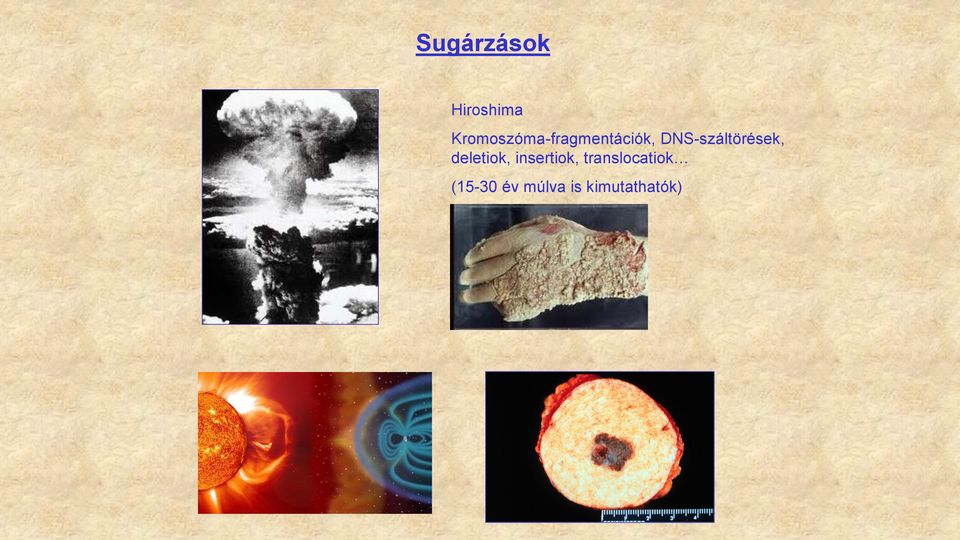 DNS-száltörések, deletiok,