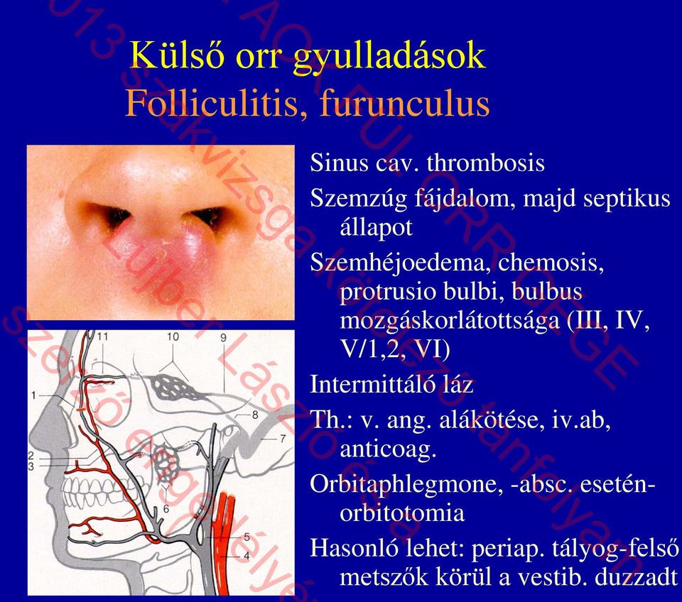 mozgáskorlátottsága (III, IV, V/1,2, VI) Intermittáló láz Th.: v. ang. alákötése, iv.ab, anticoag.