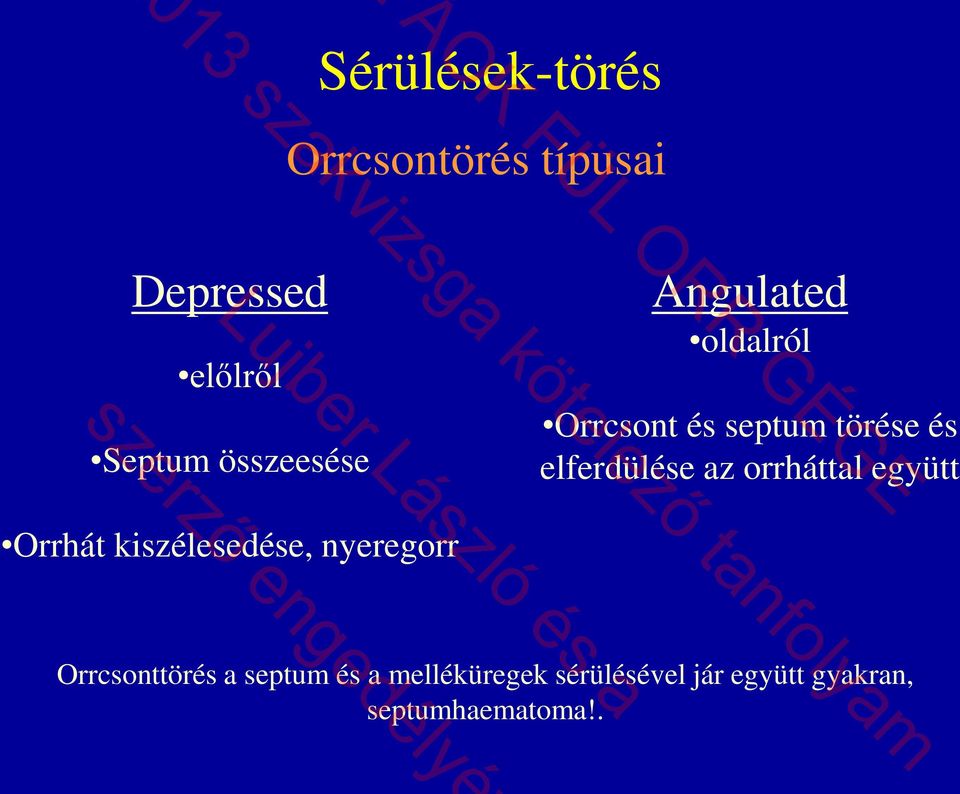 elferdülése az orrháttal együtt Orrhát kiszélesedése, nyeregorr