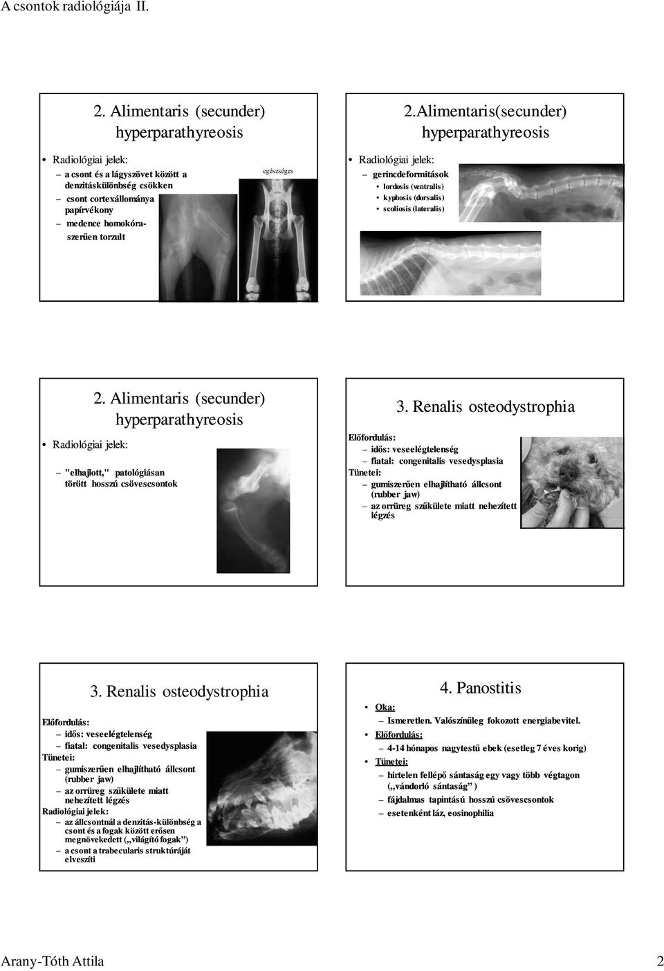 lordosis (ventralis) kyphosis (dorsalis) scoliosis (lateralis) 2. Alimentaris (secunder) hyperparathyreosis "elhajlott," patológiásan törött hosszú csövescsontok 3.