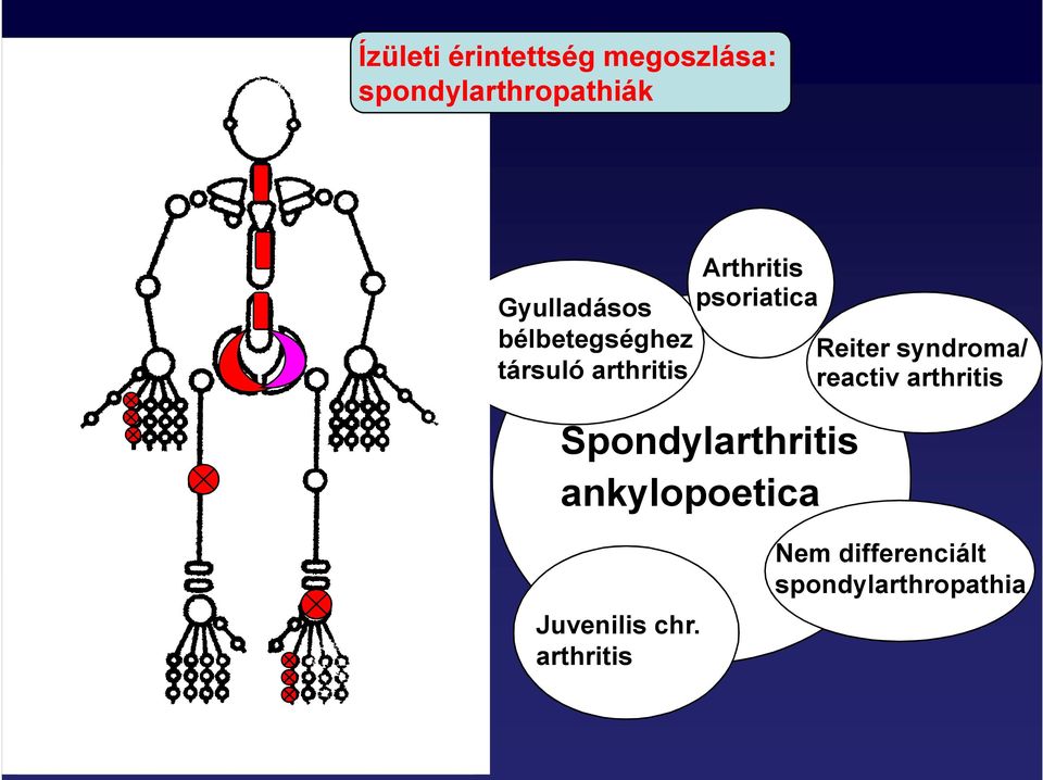 psoriatica Spondylarthritis ankylopoetica Reiter syndroma/