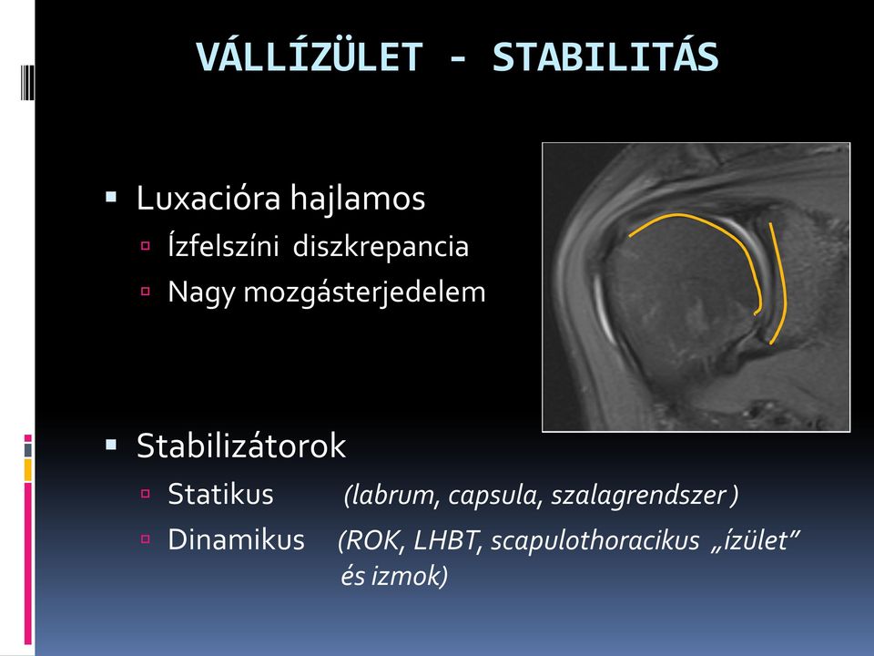 Stabilizátorok Statikus (labrum, capsula,