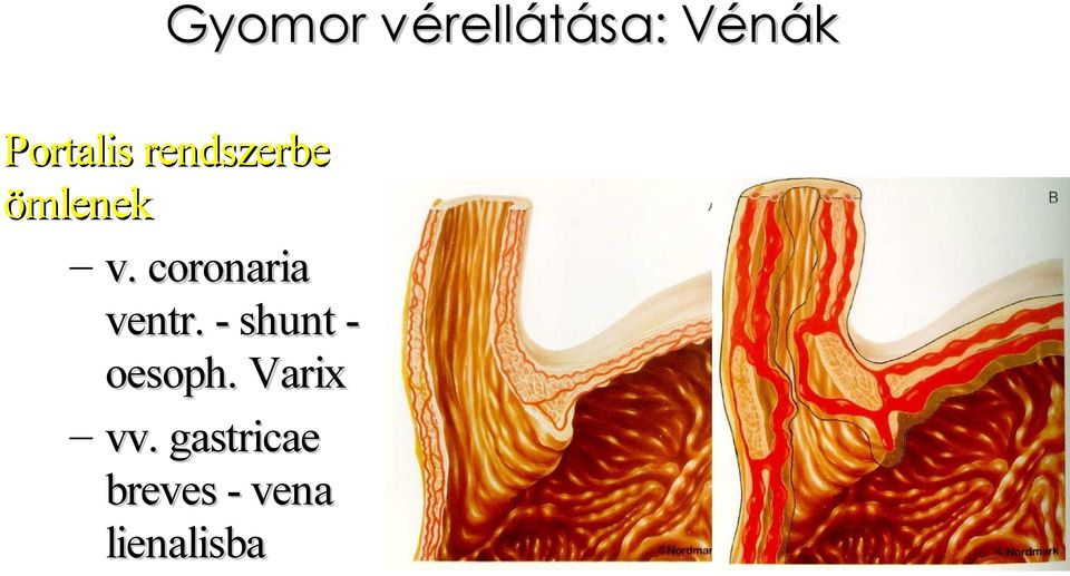 coronaria ventr. - shunt oesoph.