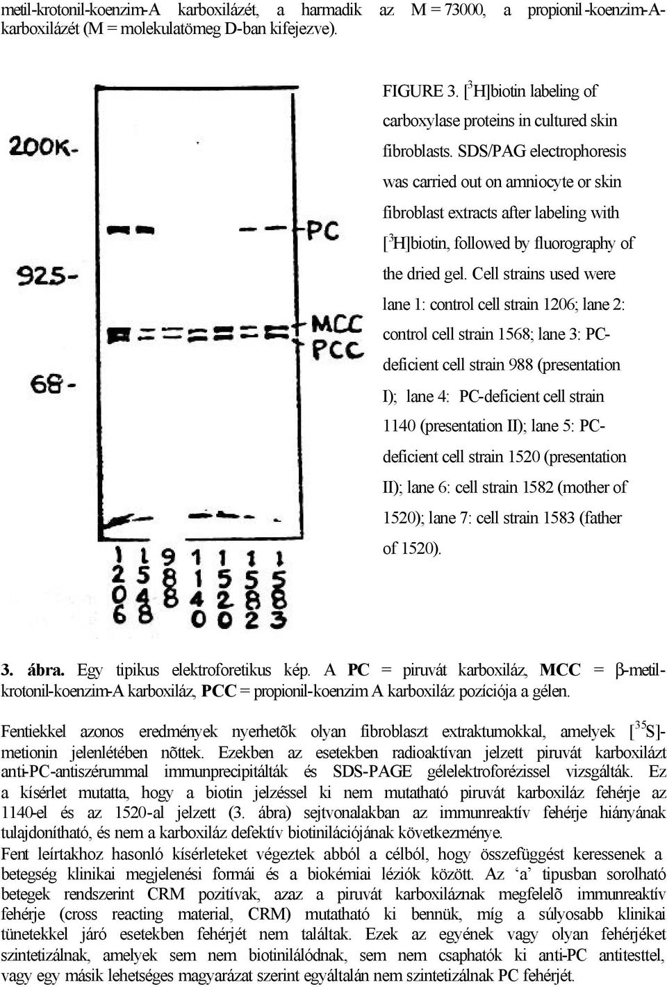 SDS/PAG electrophoresis was carried out on amniocyte or skin fibroblast extracts after labeling with [ 3 H]biotin, followed by fluorography of the dried gel.