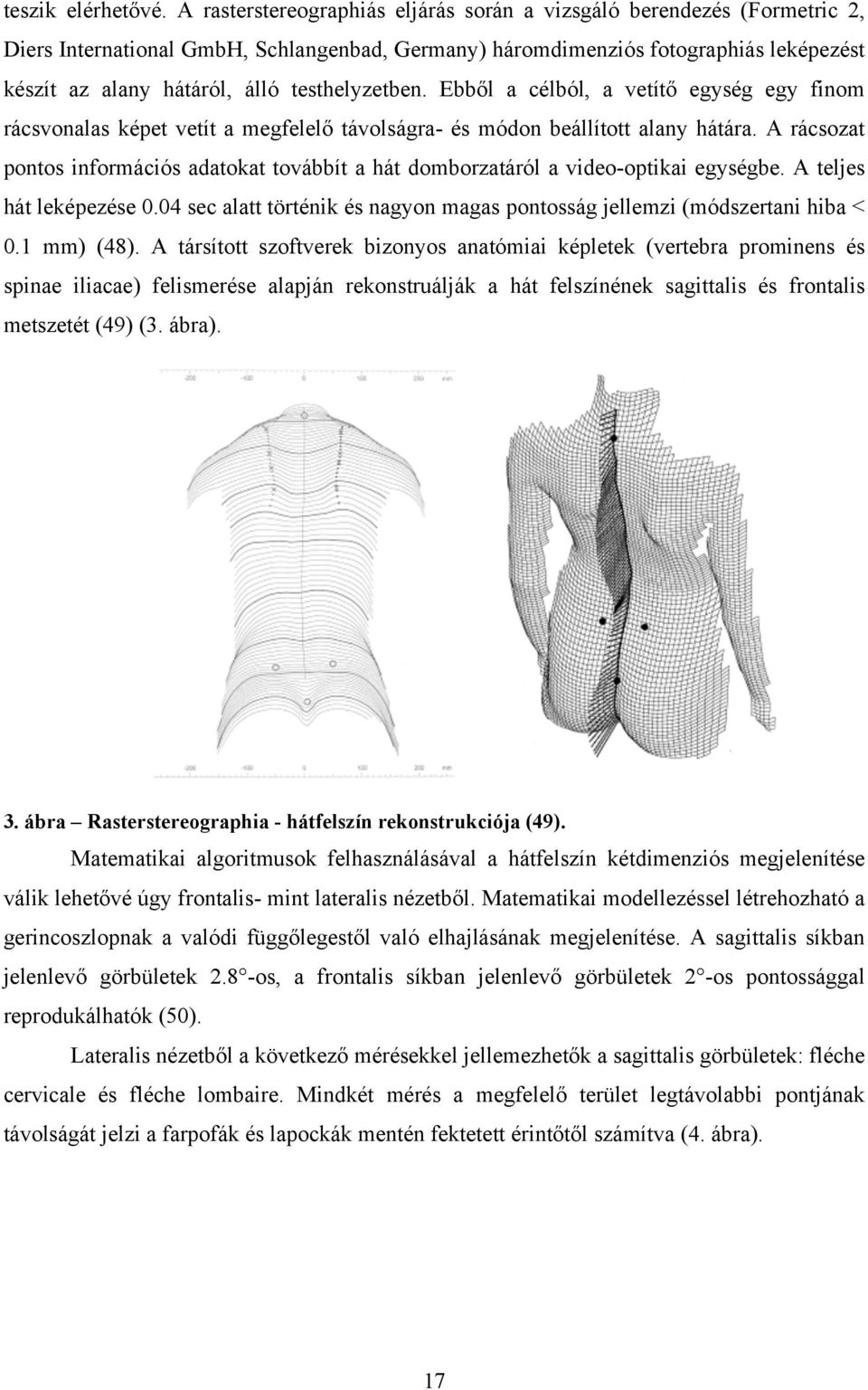 testhelyzetben. Ebből a célból, a vetítő egység egy finom rácsvonalas képet vetít a megfelelő távolságra- és módon beállított alany hátára.