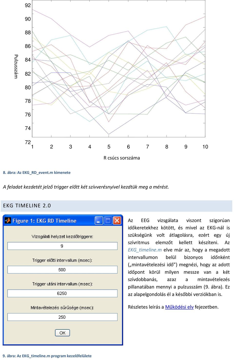 0 Az EEG vizsgálata viszont szigorúan időkeretekhez kötött, és mivel az EKG-nál is szükségünk volt átlagolásra, ezért egy új szívritmus elemzőt kellett készíteni. Az EKG_timeline.