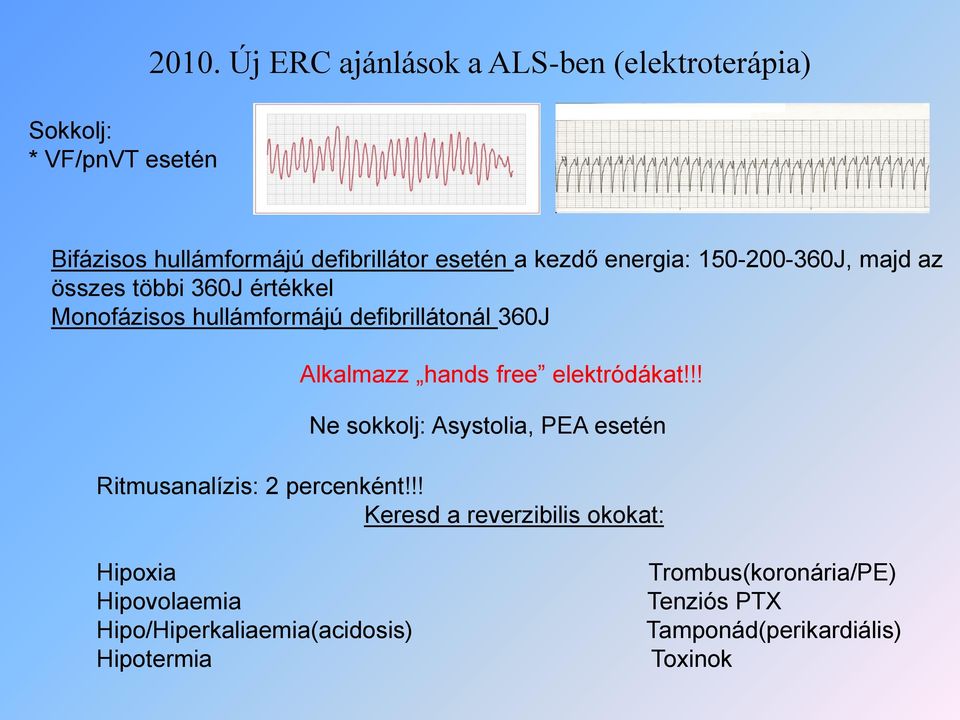 majd az összes többi 360J értékkel Monofázisos hullámformájú defibrillátonál 360J Alkalmazz hands free elektródákat!