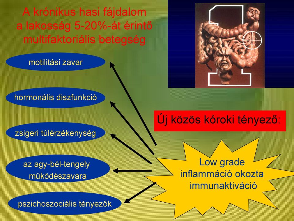 Új közös kóroki tényező: zsigeri túlérzékenység az agy-bél-tengely